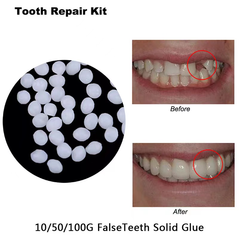 Teeth Whitening Mask - 10 グラム/バッグ歯の修理キット - 空洞充填用のサーマルビーズ、欠損した歯や接着剤を修正する義歯偽の歯ガッタパー