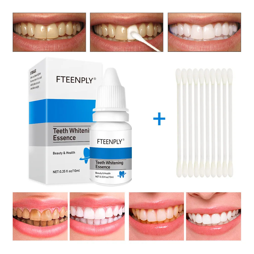 Teeth Whitening Session - 歯のホワイトニングエッセンス,口腔衛生,歯のホワイトニング,歯石の除去,汚れの歯のケア
