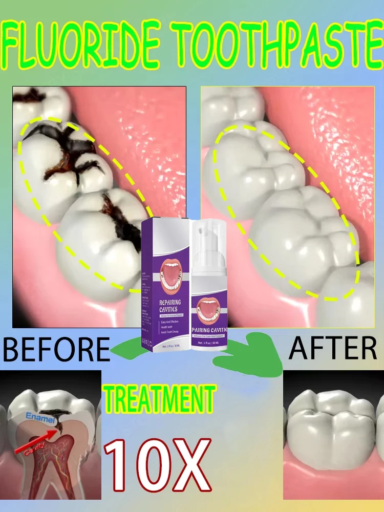 Teeth Whitening Best - 科学的な修復により、虫歯を取り除き、歯垢をきれいにし、歯を白くし、息をリフレッシュします。ベストセラーです。