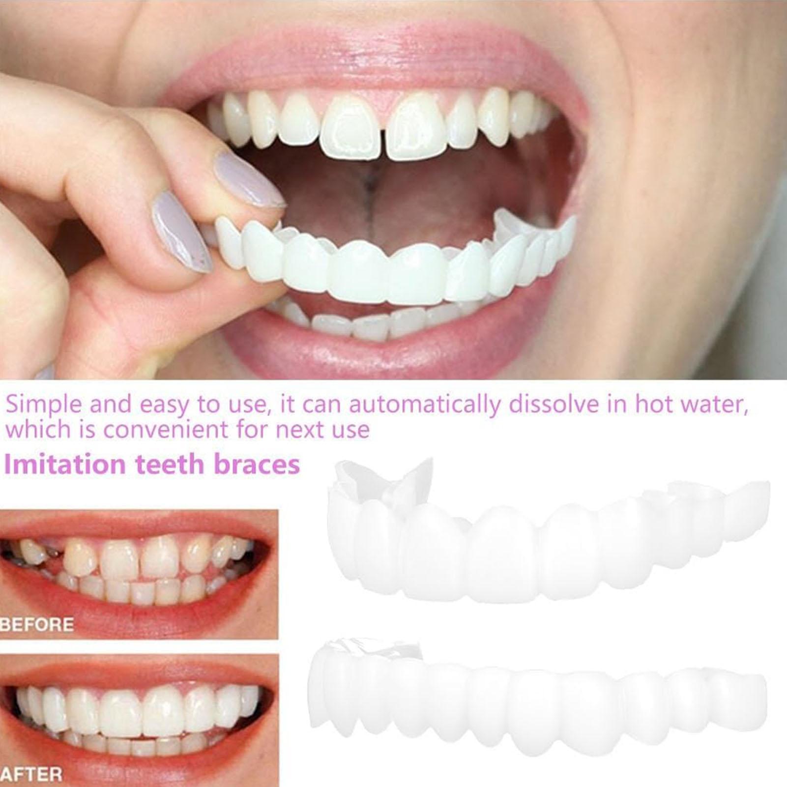 Teeth Whitening Mask - 2 個男性女性一時的な歯ベニア上部下部ベニア歯一時的な笑顔改善剤再利用可能な偽の歯カバー美白