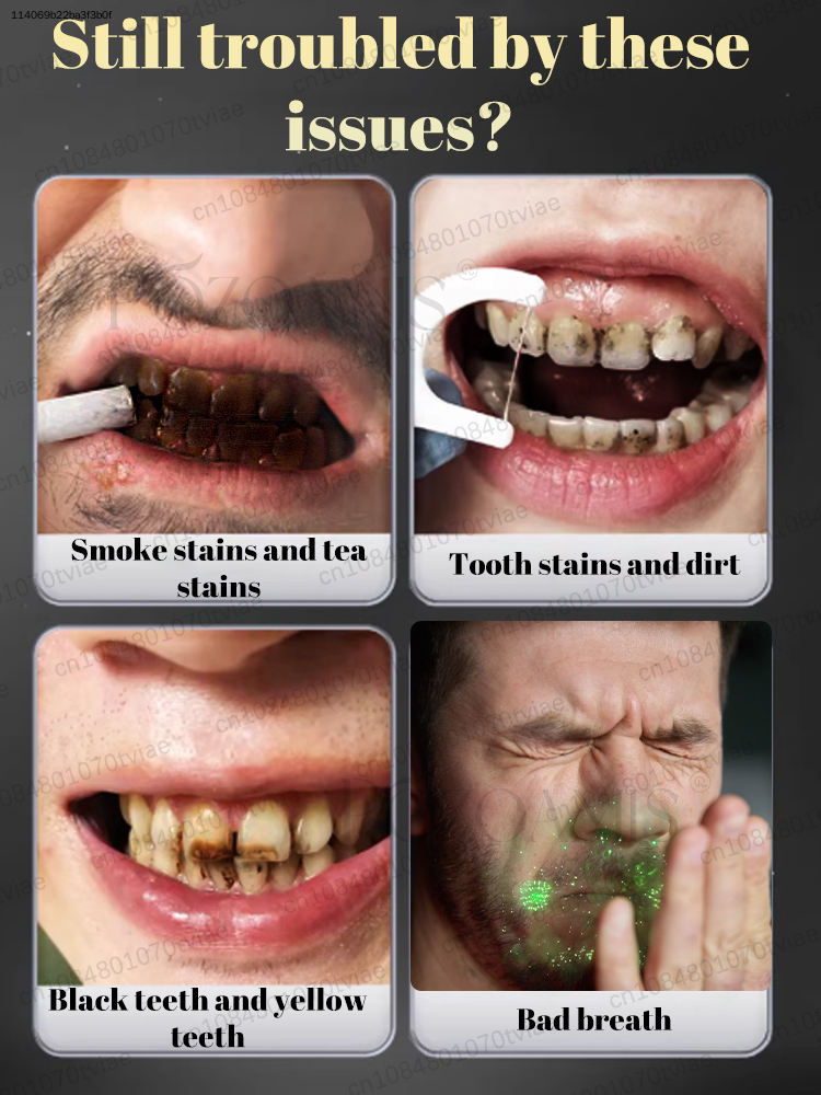 POZOAMIS 30% ハイドロキシアパタイト歯磨き粉、家 - Teeth Whitening Best のレビューと価格