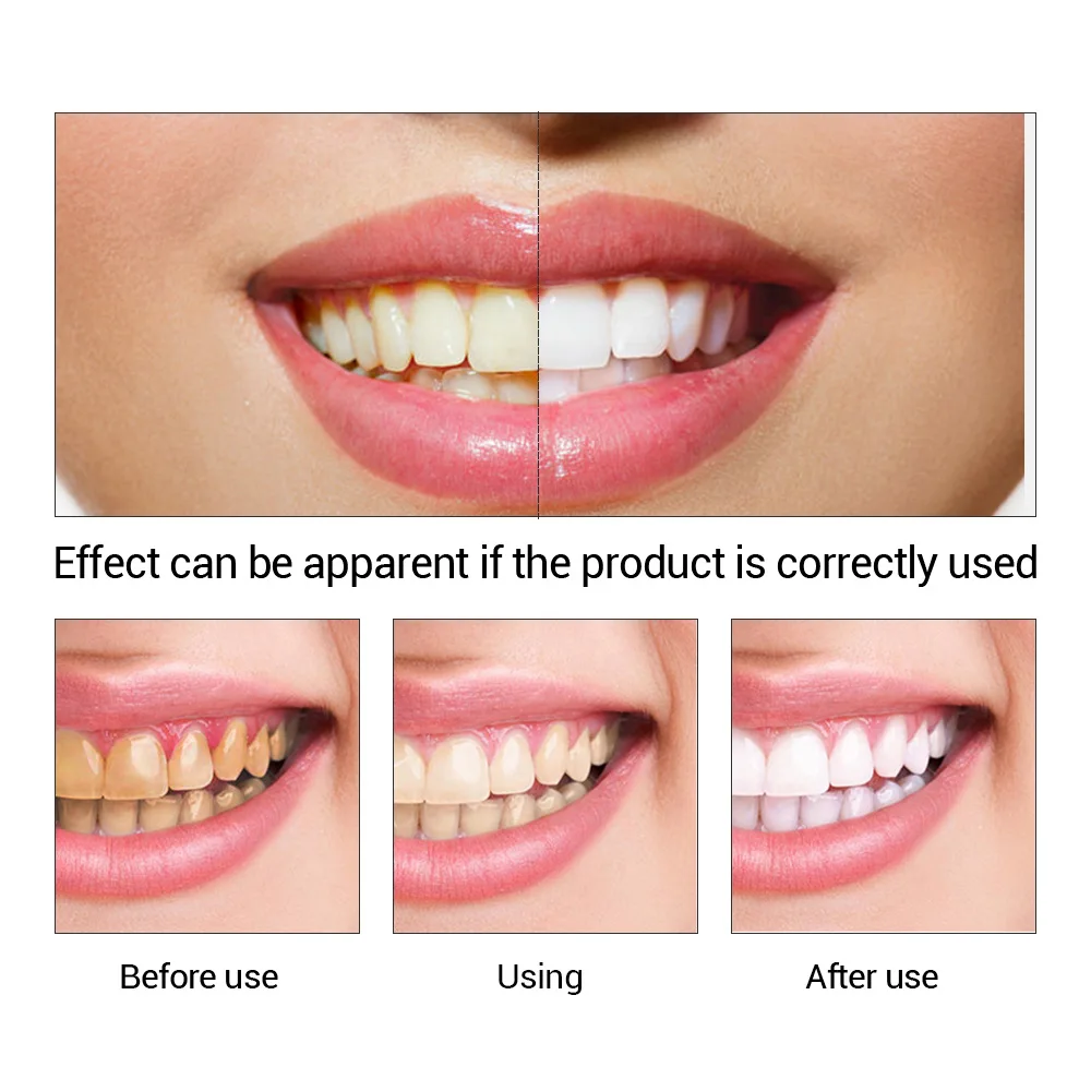 歯のホワイトニングエッセンス,口腔衛生,歯のホワイトニング, - Teeth Whitening Session のレビューと価格