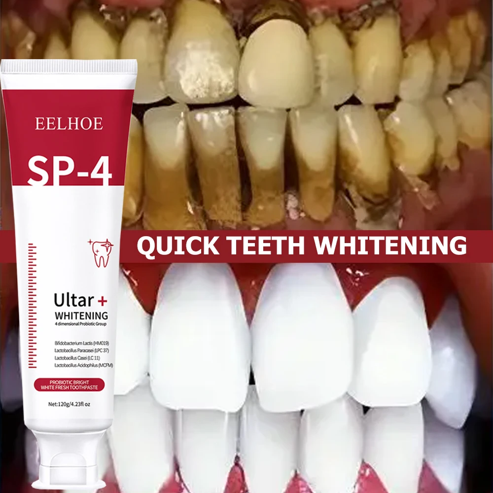 プロバイオティックホワイトニングペースト,歯磨き粉,汚れや歯 - Teeth Whitening Enzymes のレビューと価格