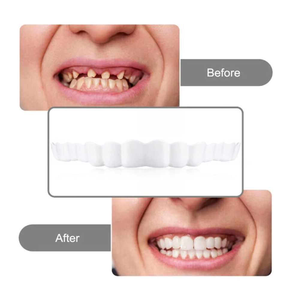 4-6 ペア上顎 & 下顎入れ歯入れ歯歯入れ歯ケア快適な歯を - Teeth Whitening Mask のレビューと価格