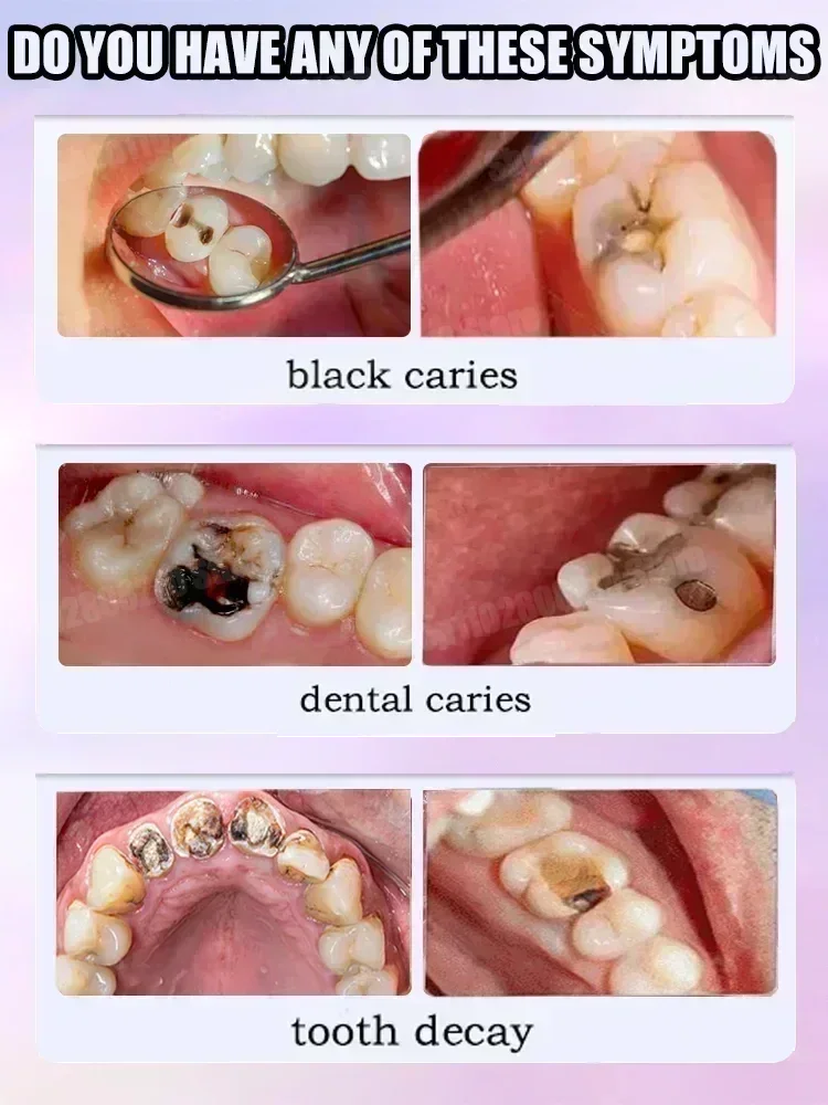 科学的な修復により、虫歯を取り除き、歯垢をきれいにし、歯を白 - Teeth Whitening Best のレビューと価格