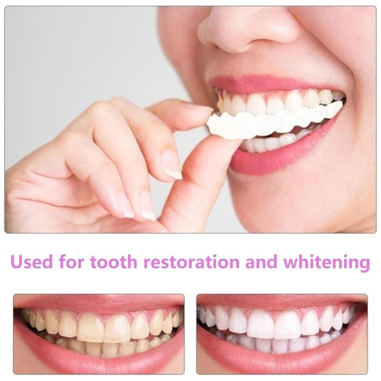 2 個男性女性一時的な歯ベニア上部下部ベニア歯一時的な笑顔改 - Teeth Whitening Mask のレビューと価格
