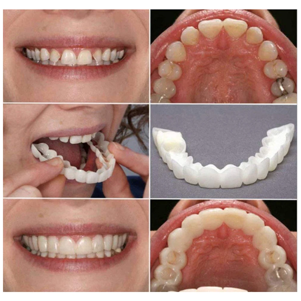 男性と女性のための歯の学生、入れ歯の快適さ、上下の位置、代替 - Teeth Whitening Mask のレビューと価格